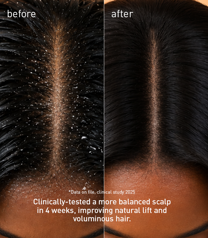 Voshbon Volumize Freeze-Dried Hair Wash Voshbon Beauty